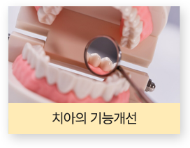 치아교정으로 개선되는 저작 기능